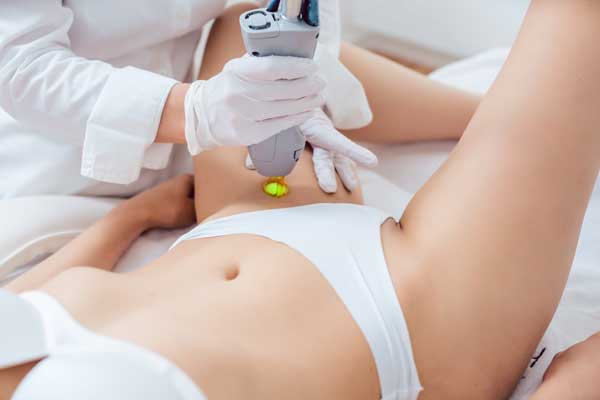 LASERONTHARING-VROUW
