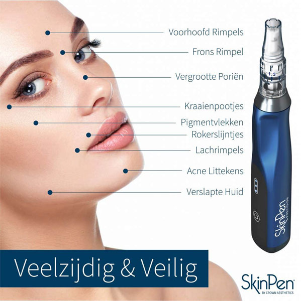 SkinPen-veelzijdig-veilig Skinpen veelzijdig en veilig