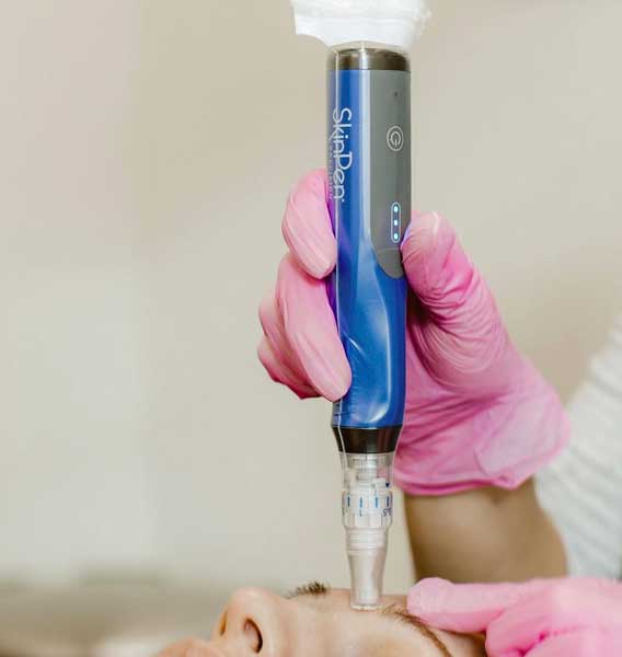 Skinpen-behandeling Skinpen behandeling huid