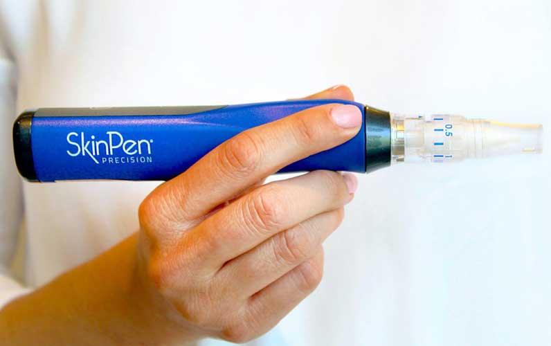 Skinpen-microneedling Skinpen Microneedling