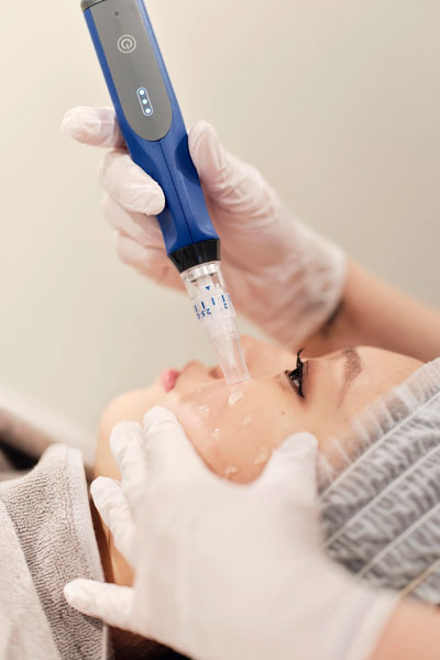 skinpen Skinpen Microneedling